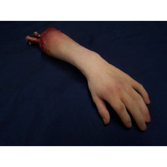 Exposed Bone Pale Child Right Hand