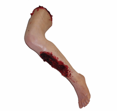 Exposed Bone Sonia Leg