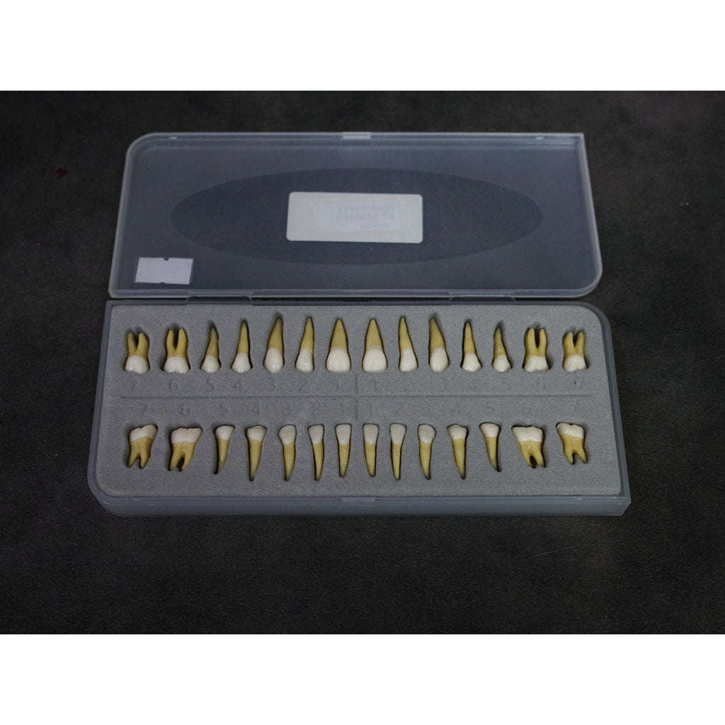 Loose Dental Tooth Set