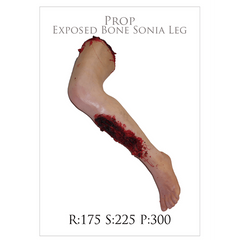 Exposed Bone Sonia Leg