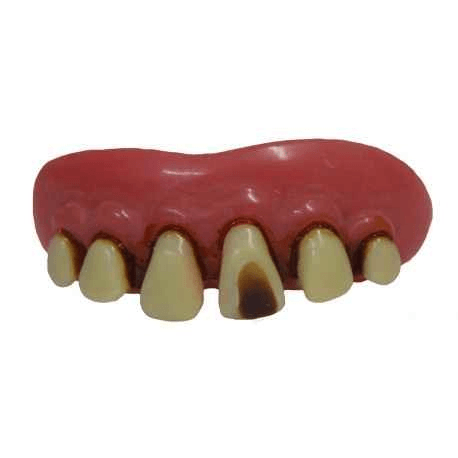 Caveman Teeth w/ Cavity