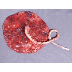 Realistic Silicone Placenta Prop