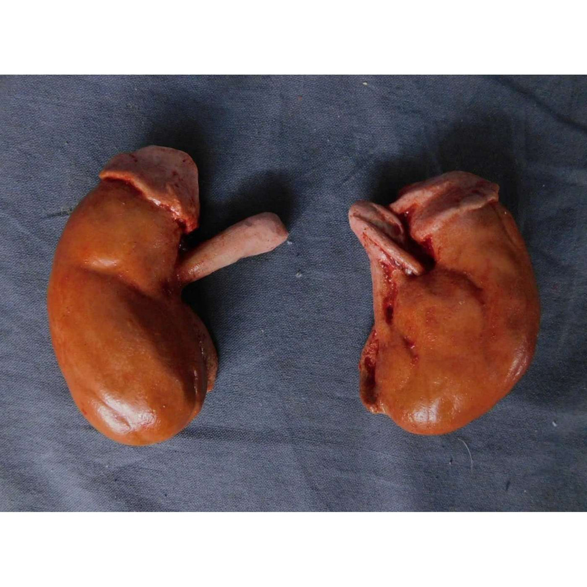 Kidney Pair Prop
